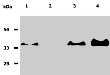 Immunoprecipitation