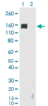 Western Blot