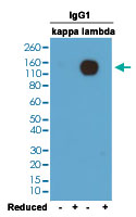 Western Blot