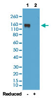 Western Blot