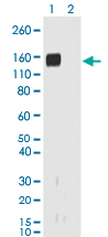 Western Blot