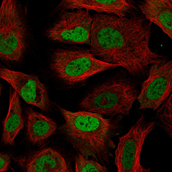 Immunofluorescence