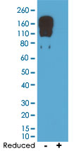 Western Blot