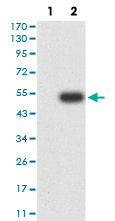 Western Blot (Transfected lysate)