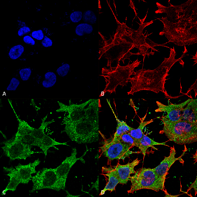 Immunocytochemistry