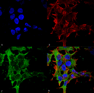 Immunocytochemistry