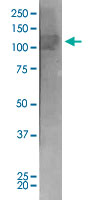 Western Blot (Tissue lysate)