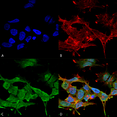 Immunocytochemistry