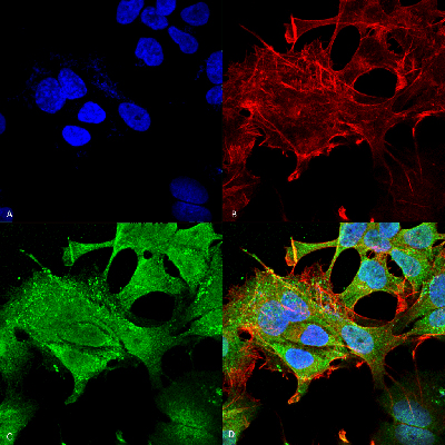 Immunocytochemistry