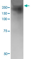 Western Blot (Tissue lysate)