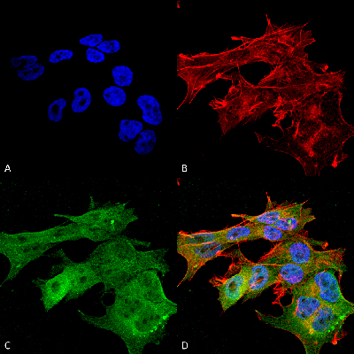 Immunocytochemistry