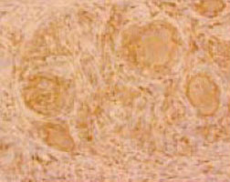 Immunohistochemistry