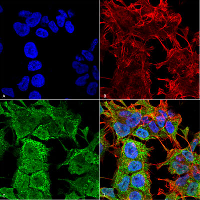 Immunocytochemistry