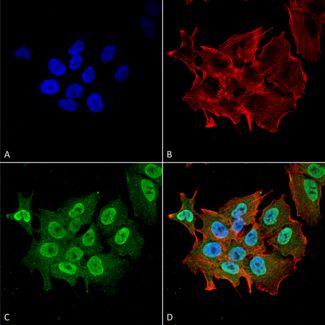 Immunocytochemistry