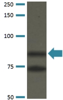 Western Blot (Transfected lysate)