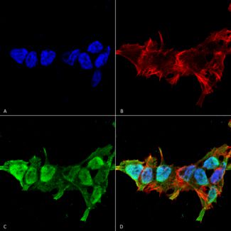 Immunocytochemistry