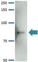 Western Blot (Tissue lysate)