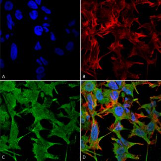 Immunocytochemistry