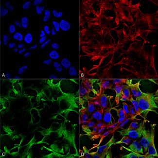 Immunocytochemistry