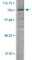 Western Blot (Cell lysate)