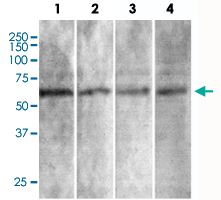 Western Blot (Tissue lysate)