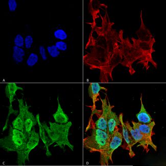 Immunocytochemistry