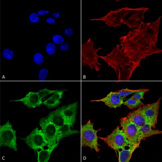 Immunocytochemistry