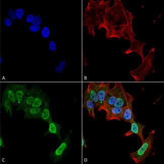 Immunocytochemistry