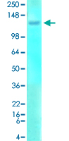 Western Blot (Tissue lysate)