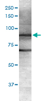 Western Blot (Tissue lysate)