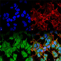 Immunocytochemistry