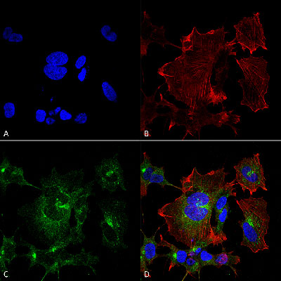 Immunocytochemistry