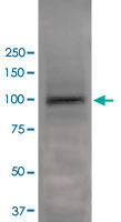 Western Blot (Tissue lysate)