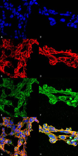 Immunocytochemistry