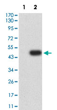 Western Blot (Transfected lysate)