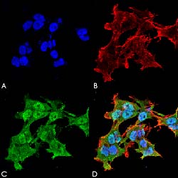 Immunofluorescence