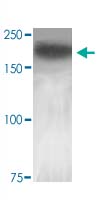 Western Blot (Tissue lysate)