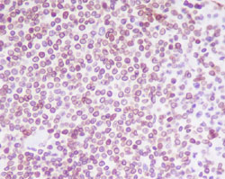 Immunohistochemistry (Formalin/PFA-fixed paraffin-embedded sections)