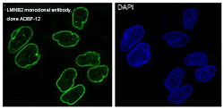 Immunofluorescence