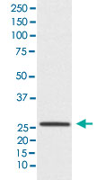 Western Blot (Cell lysate)