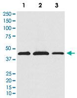 Western Blot