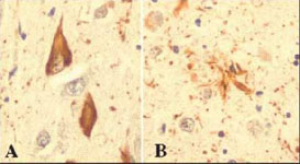 Immunohistochemistry