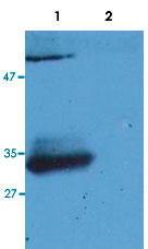 Western Blot (Recombinant protein)