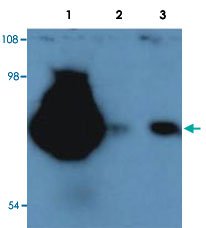 Western Blot (Tissue lysate)