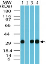 Western Blot (Tissue lysate)