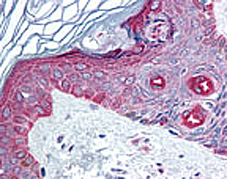 Immunohistochemistry