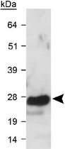 Western Blot (Tissue lysate)