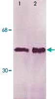 Western Blot