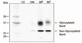 Western Blot (Tissue lysate)