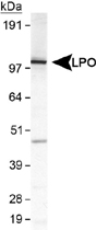 Western Blot (Cell lysate)